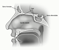Sección transversal de los oídos paranasales. Se resaltan las áreas en las que en el moco se puede detener e inflamar las paredes provocando la sinusitis. El video curso enseña técnicas para aliviar los síntomas.